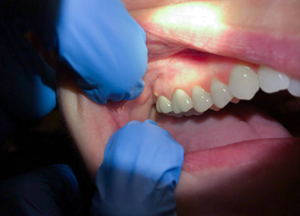 Best Emergency Root Canal Therapy in Shawnee, OK
