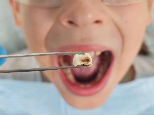 Best Urgent Dental Care for Toothaches in Shawnee, OK