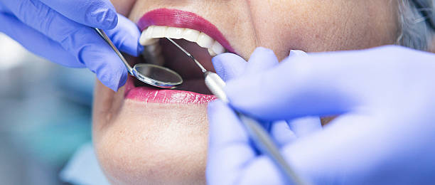 Best Knocked-Out Tooth (Avulsed Tooth) Treatment in Shawnee, OK